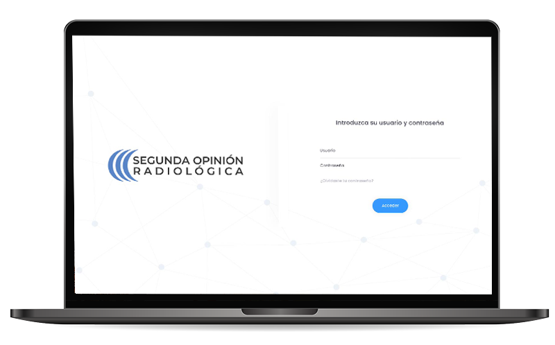 Área Privada Segunda Opinión Radiológica
